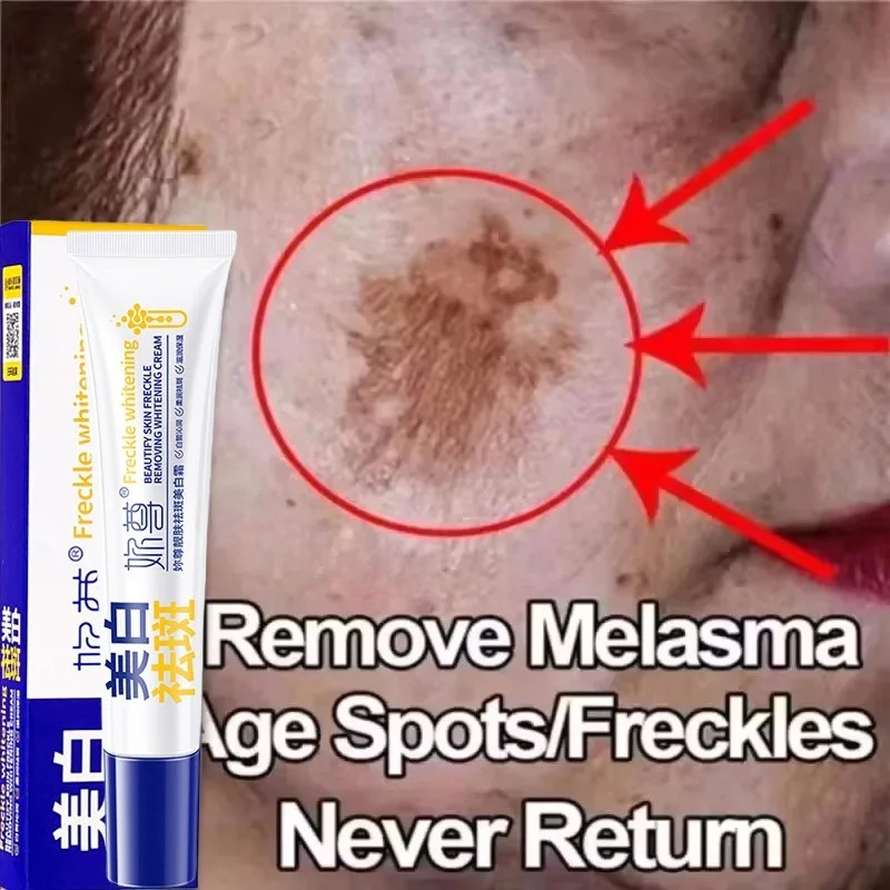 Skincare Korea - Potente crema blanqueadora eliminadora de manchas,