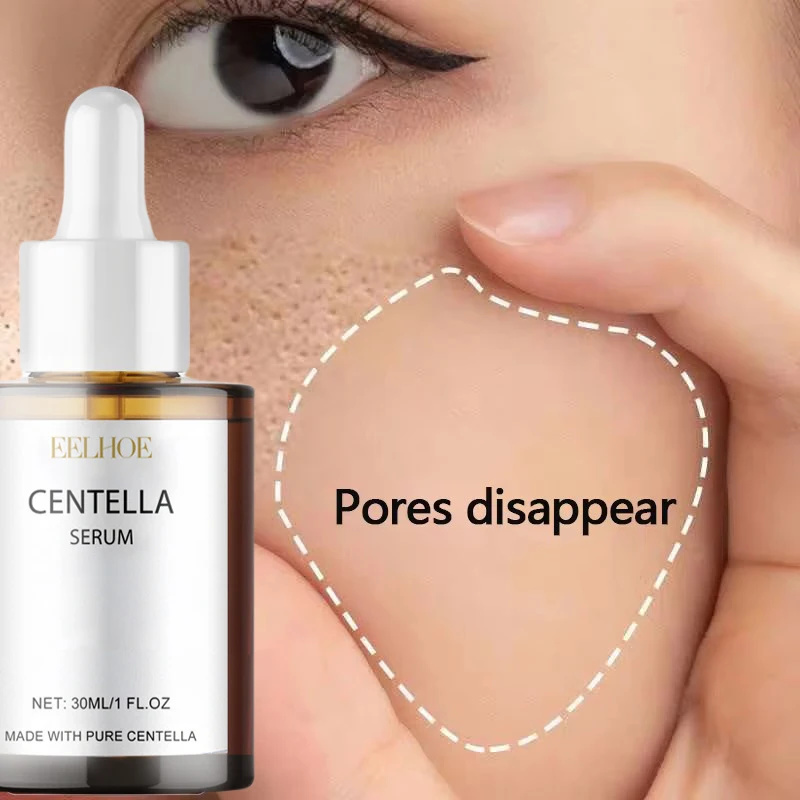 Skincare Centella - Centella Asiatica suero Facial nutre la