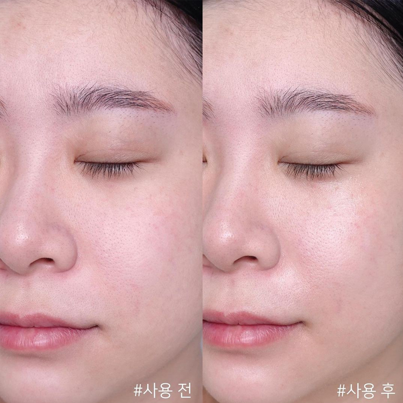 Crema Centella Asiatica Time R - Skincare Centella reseña y precio