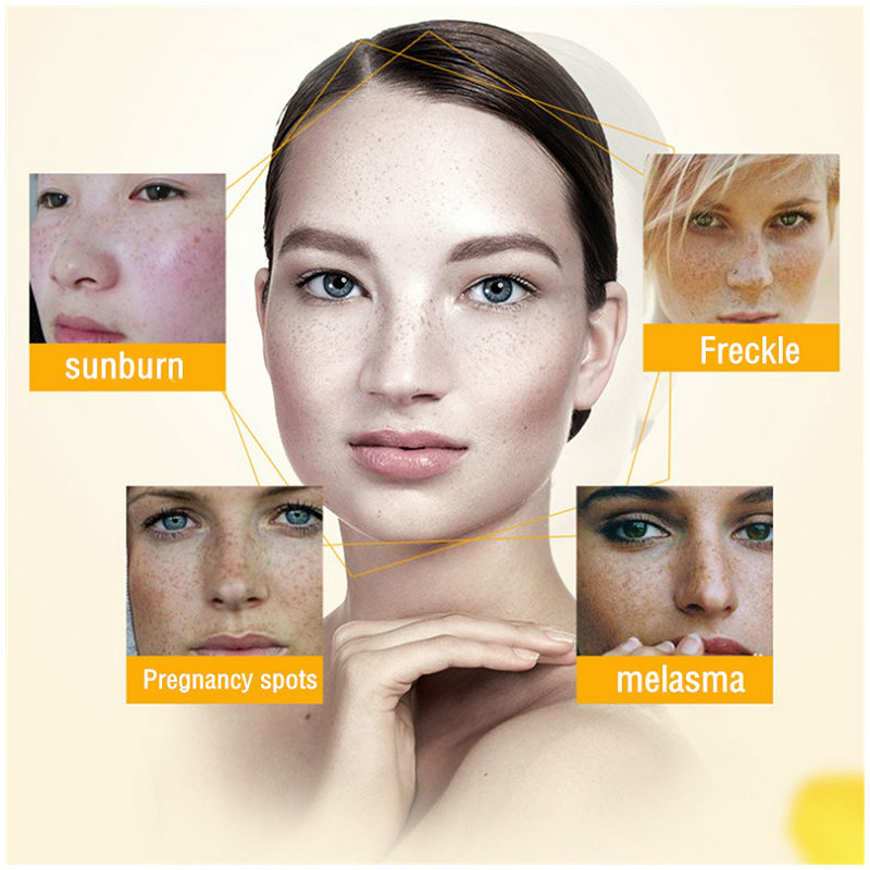 Dimollaure-crema blanqueadora  - Skincare Korea reseña y precio