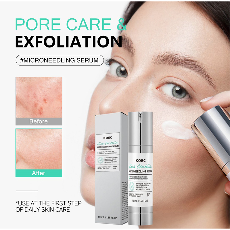 Suero de microagujas Spicule,  - Skincare Centella reseña y precio