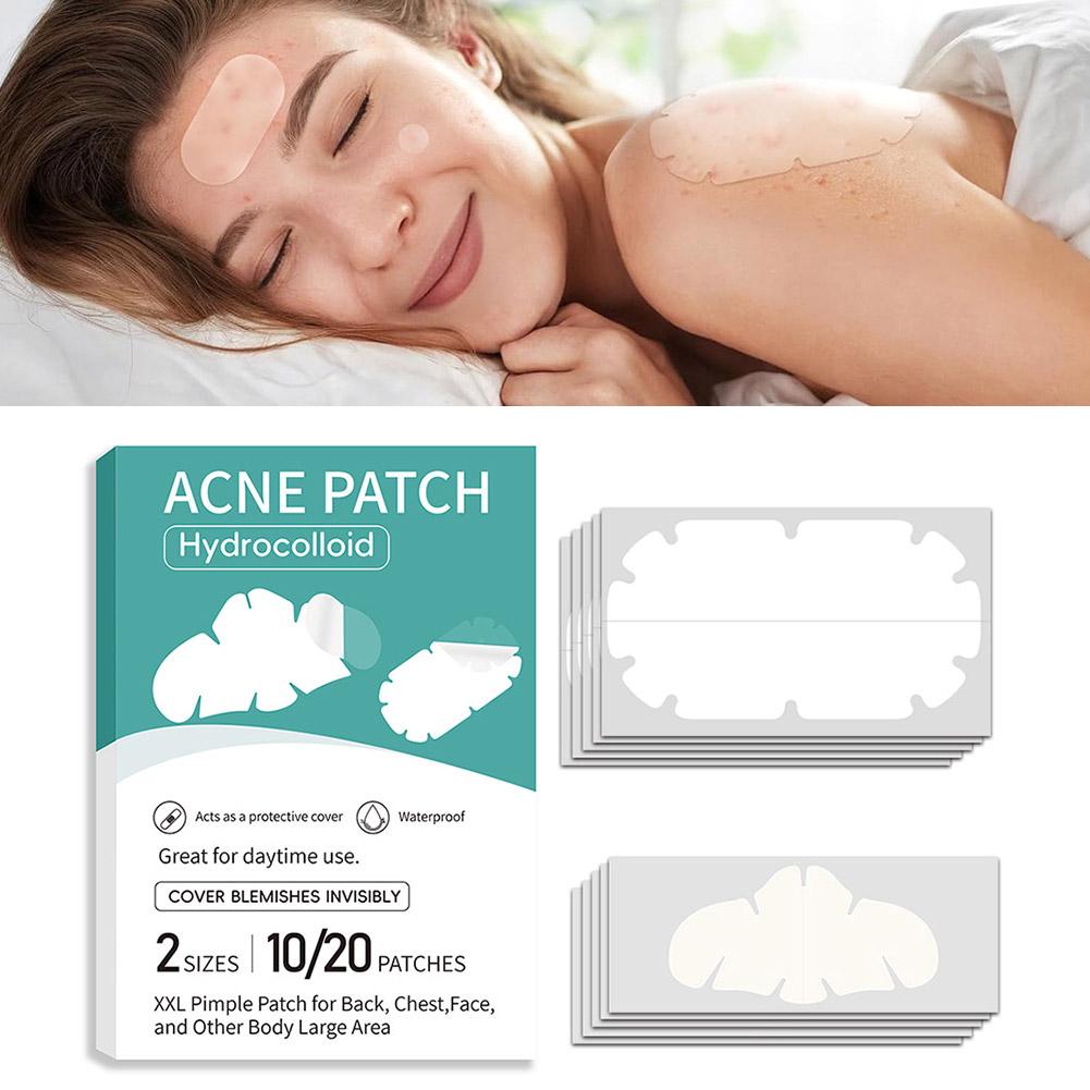 Parche para acné combinado de  - Skincare Oil Control reseña y precio