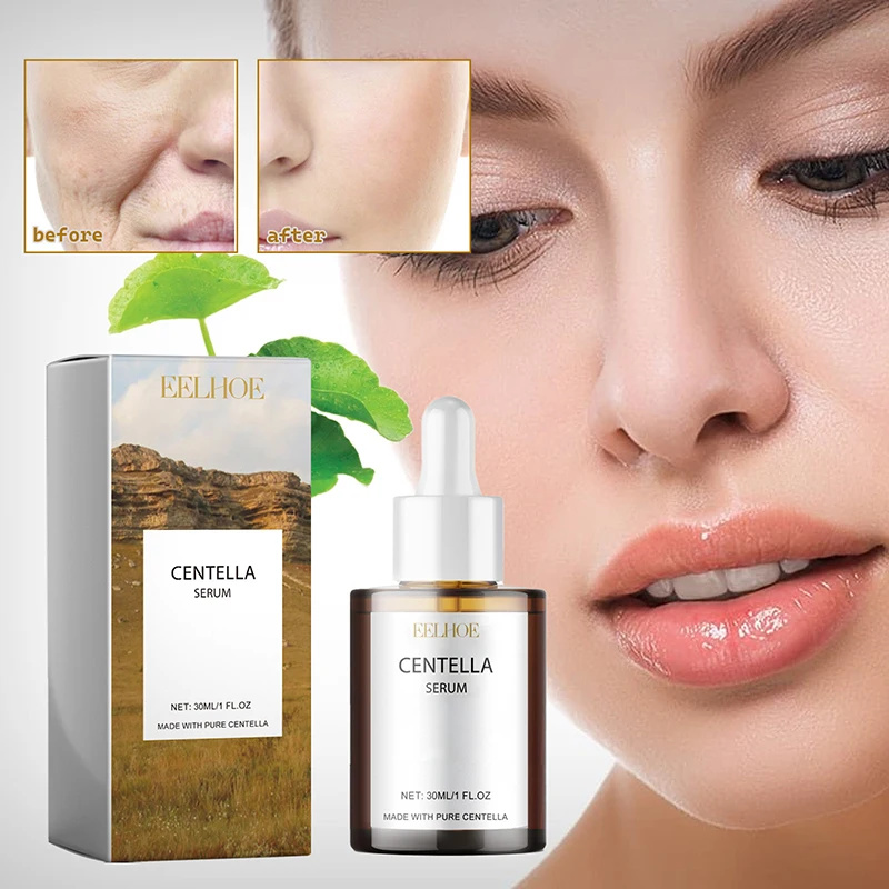 Centella Asiatica suero Facial - Skincare Centella reseña y precio