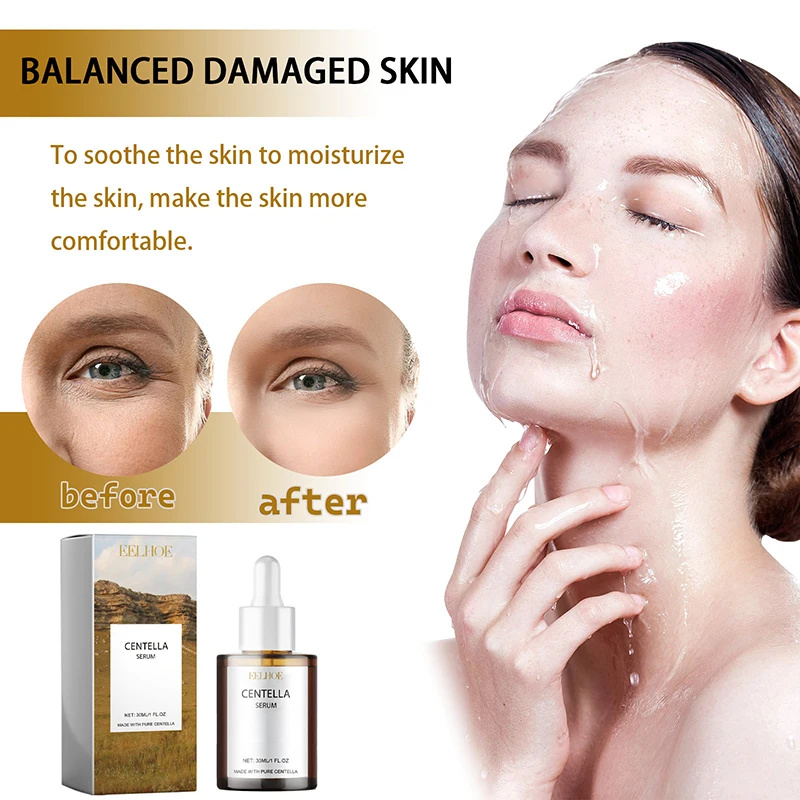 Centella Asiatica suero Facial - Skincare Centella reseña y precio